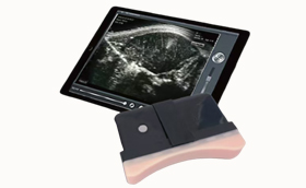 <font color='#0033CC'>VT-B28 Wireless Smart Ultrasound for Beef tenderloin</font>
